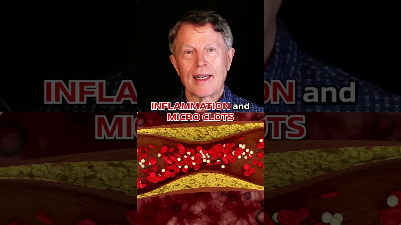 Как я использую аспирин для очистки артерий