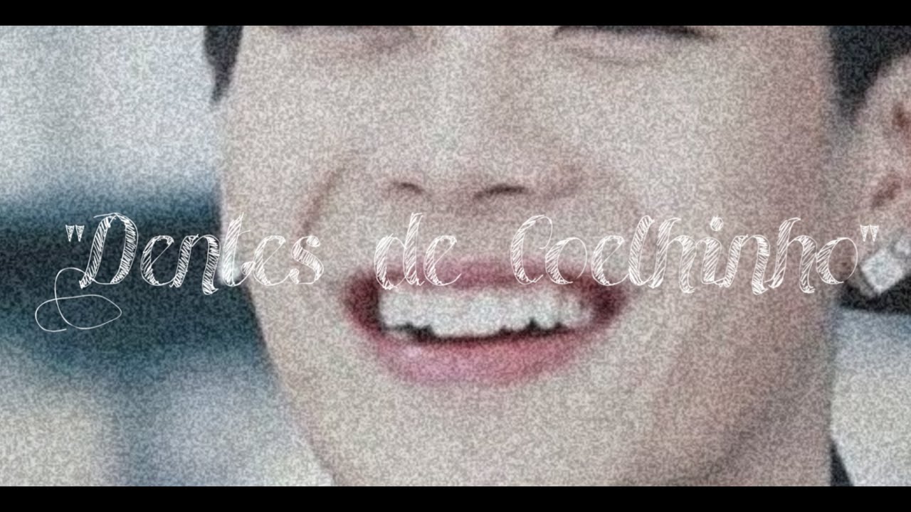 • Dentes Incisivos Centrais Longos (dentes de coelhinho) •