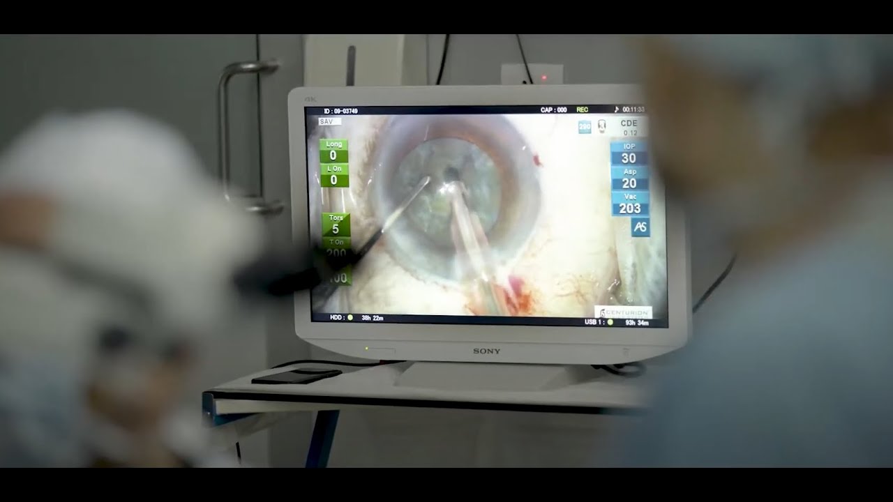 Using the MCC-1000MD HD video camera in surgery