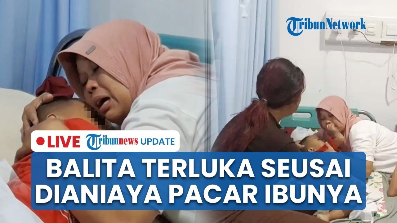 🔴LIVE: Balita 2,5 Tahun di Karawang Alami Luka Serius seusai Dianiaya Pacar Ibu Pakai Tang