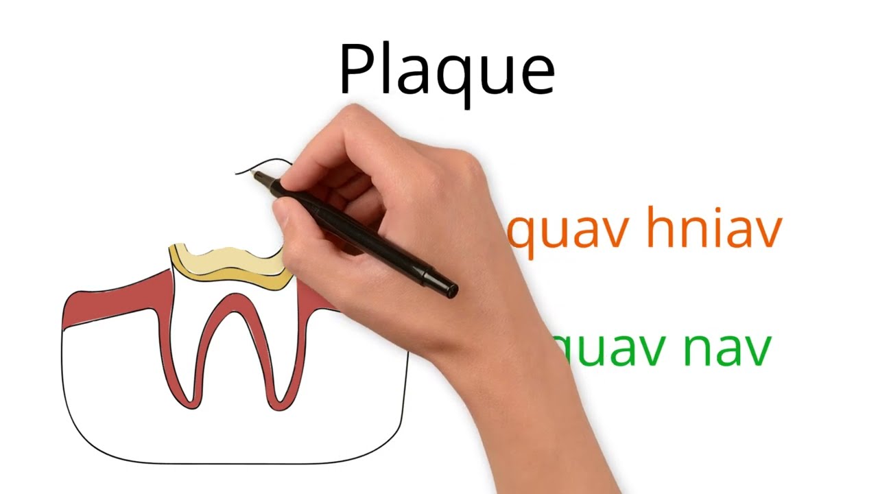 Common Dental Terms in Hmong Part 1  #hmong #medical #terminology