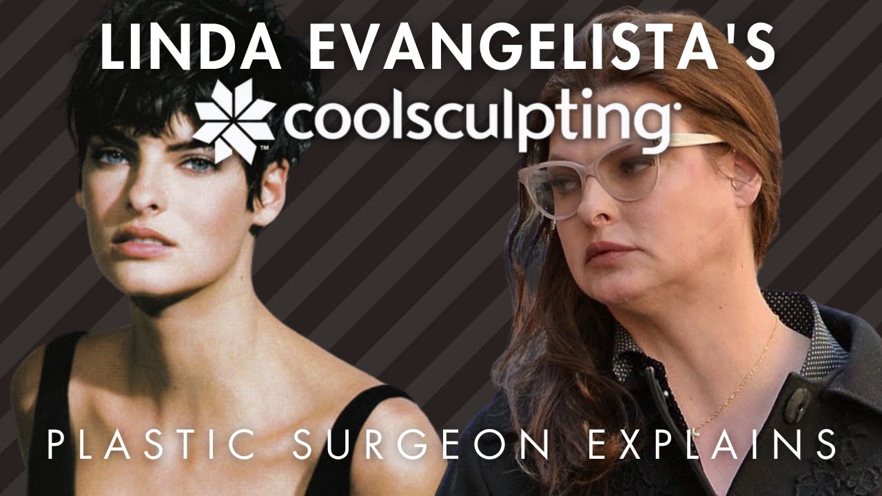 Plastic Surgeon Explains Linda Evangelista's CoolSculpting That Left Her 