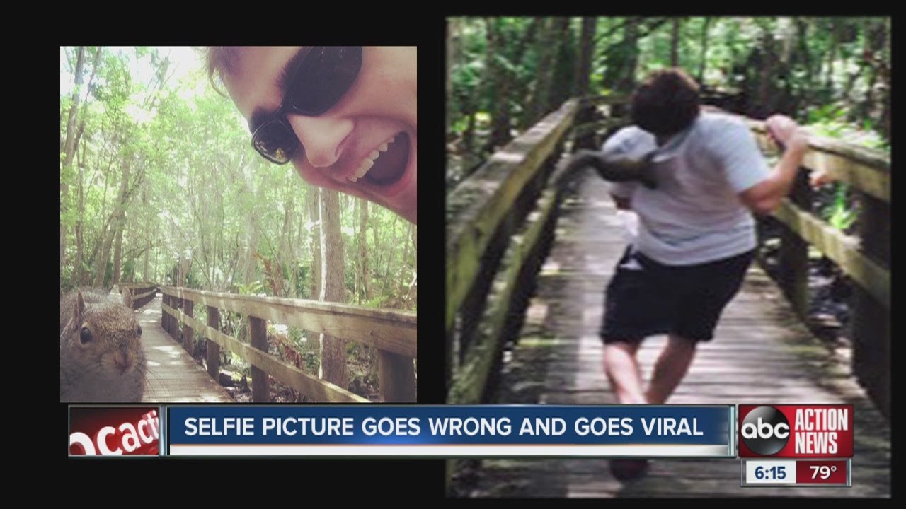 Selfie with a squirrel goes wrong