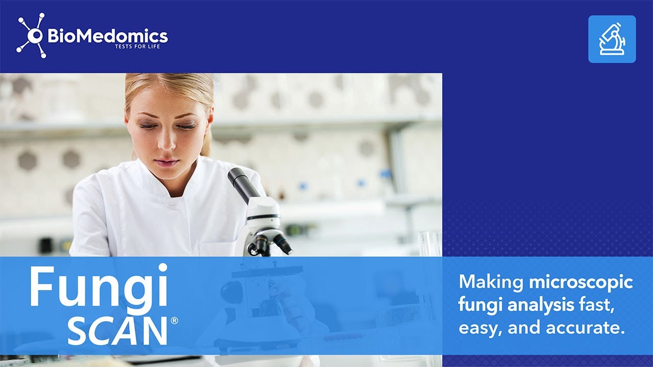 Introducing BioMedomics Fungi SCAN All-In-One Stain