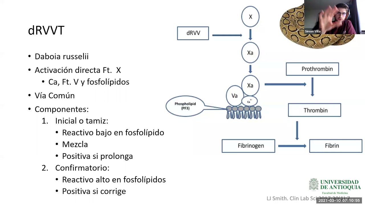 Síndrome Antifosfolípido: Diagnóstico y Controversias - Dr. Simón Villa