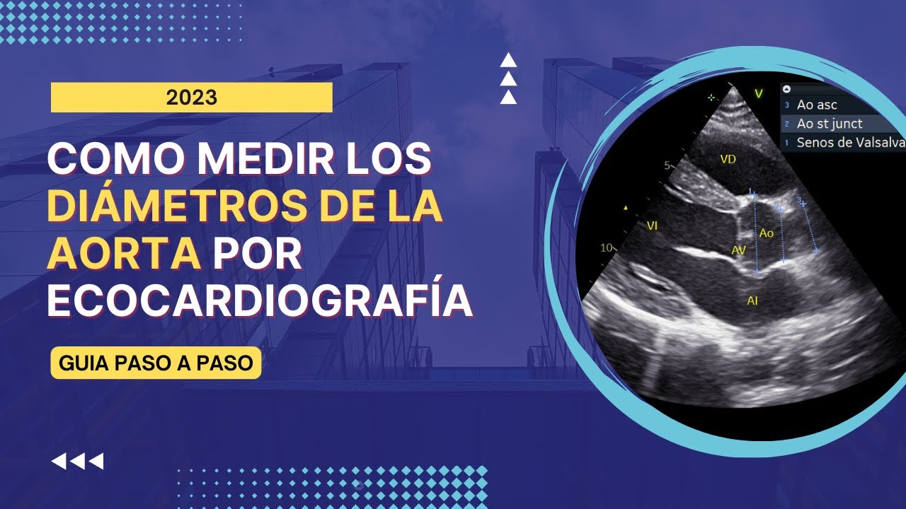 🤓[Como medir] los 🎯DIÁMETROS DE LA AORTA por ECOCARDIOGRAFÍA: Guía paso a a paso