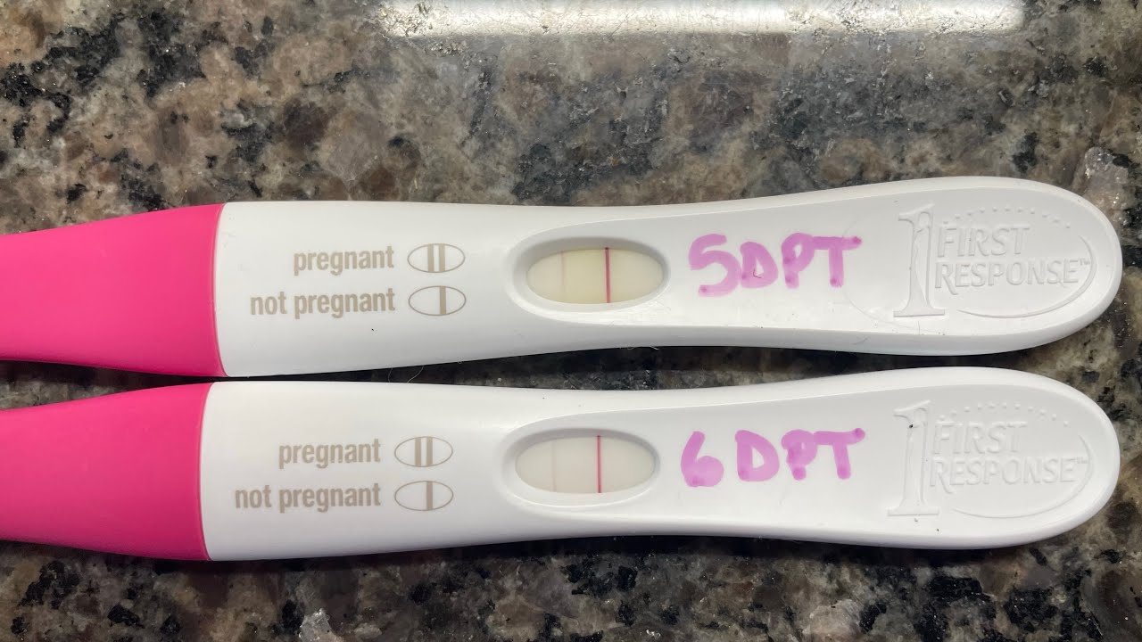 FET #2 6dp6dt