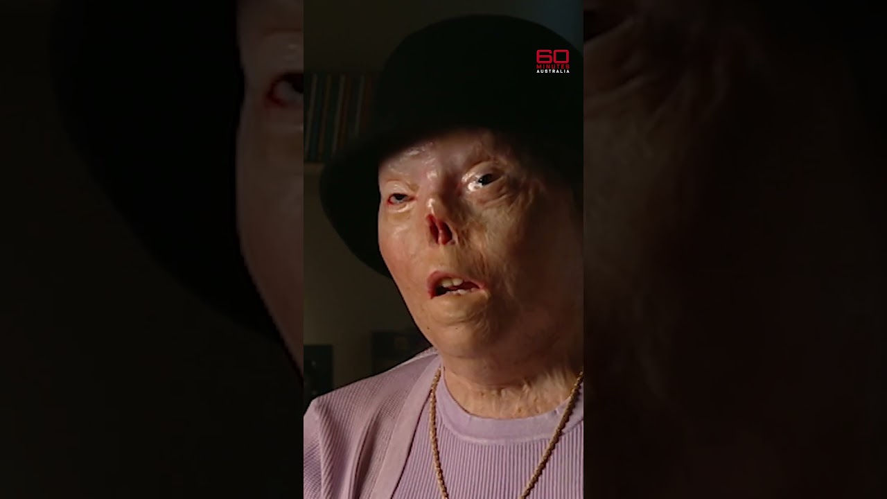 Drunk driving victim's incredible recovery | 60 Minutes Australia