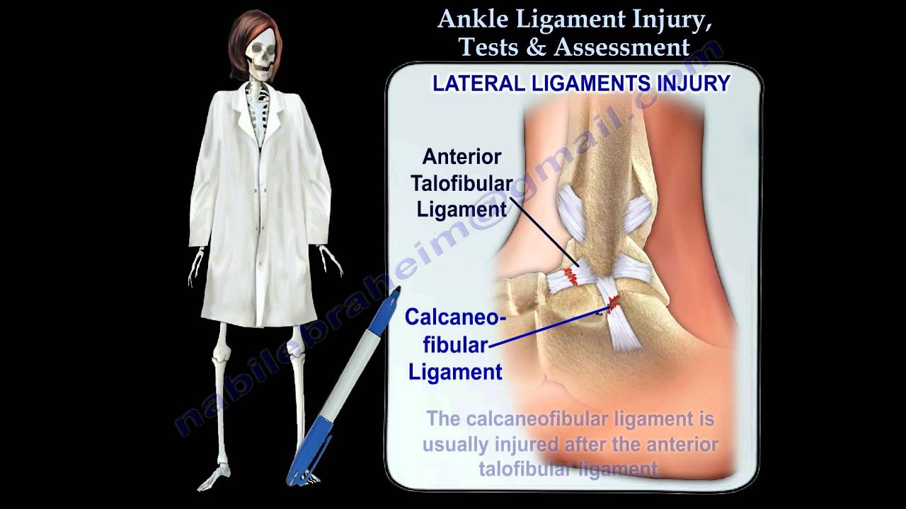 Ankle Ligament Injury Tests & Assessment - Everything You Need To Know - Dr. Nabil Ebraheim