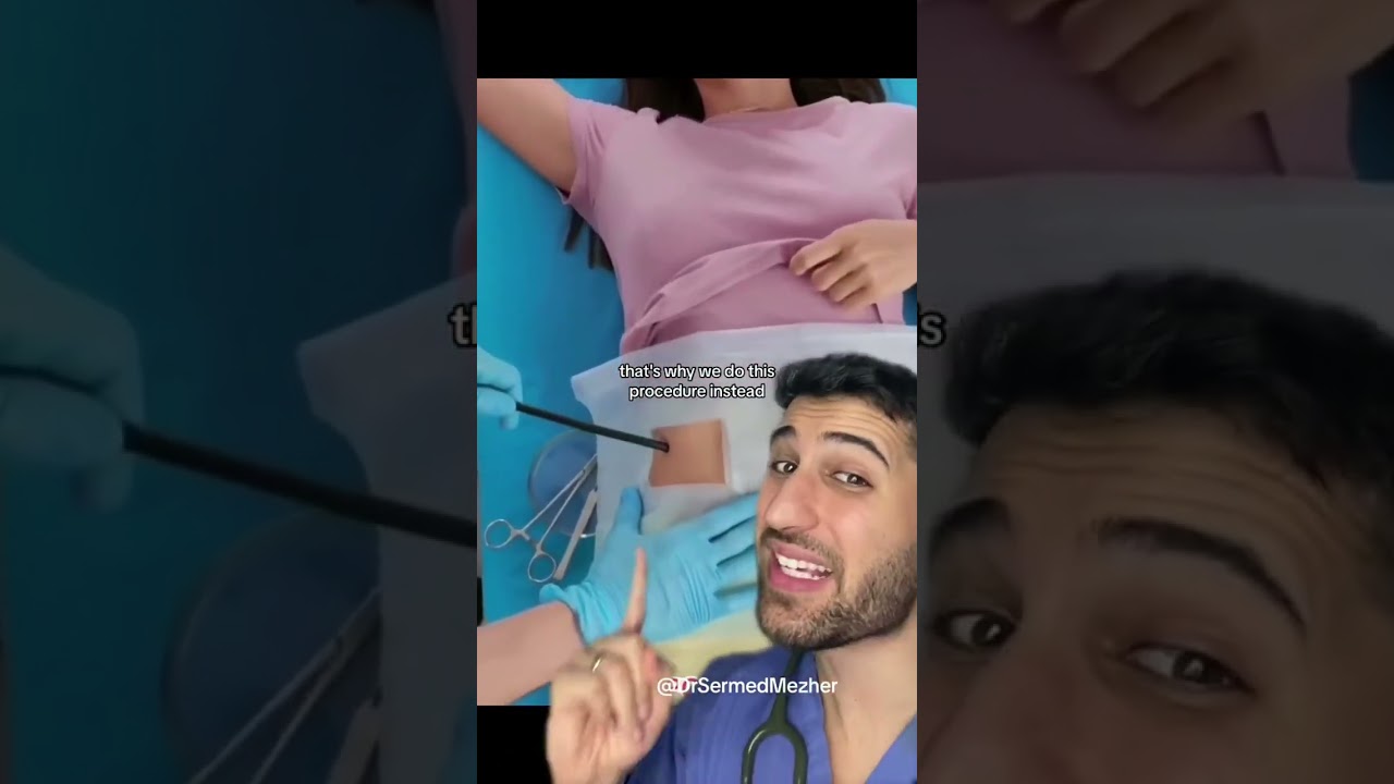 How Do We Remove a Large Kidney Stone? 