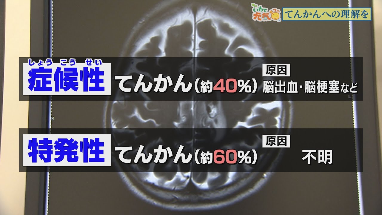 いわて元気○（マル）　【てんかんに理解を】（2021/3/23放送　ニュースプラス１いわて）