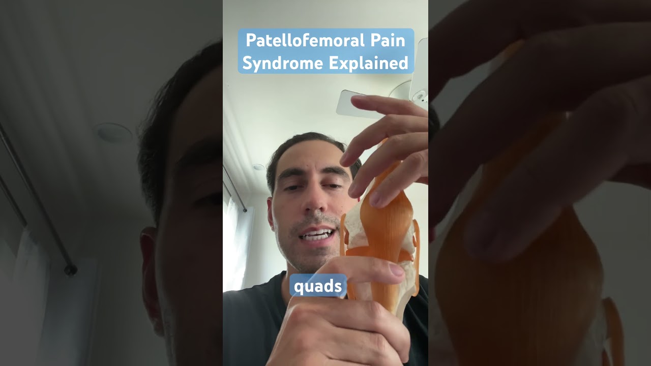 Patellofemoral pain syndrome explained by physical therapist 