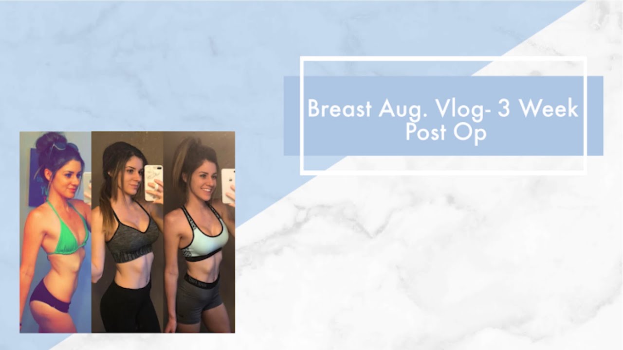 Quick 3 Week Post Op Update- Breast Aug. Vlog #3