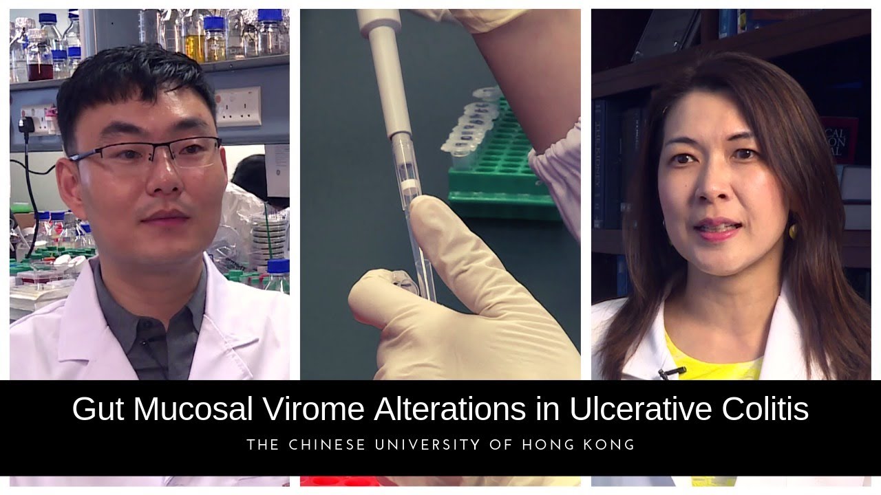Gut mucosal virome alterations in ulcerative colitis