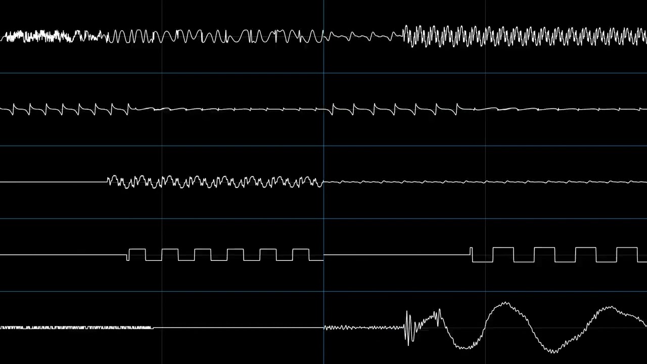 Knuckles' Chaotix - Midnight Greenhouse (oscilloscope view)