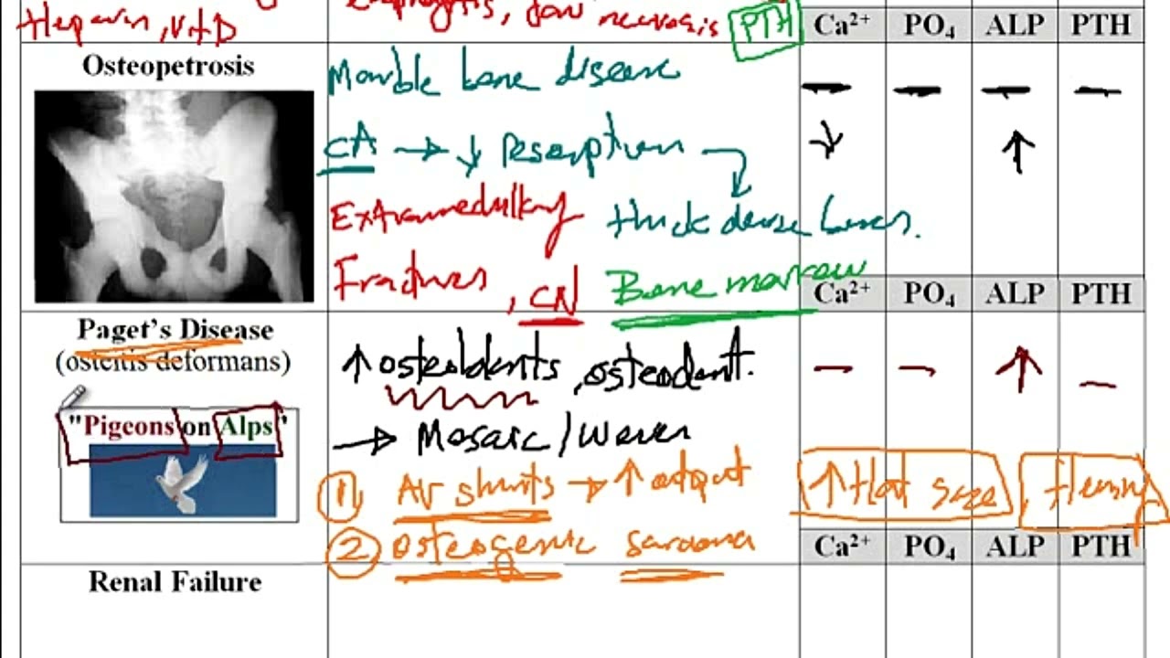 Видео USMLE ACE 185: Основные метаболические нарушения костей: классификация, признаки и сопутств...