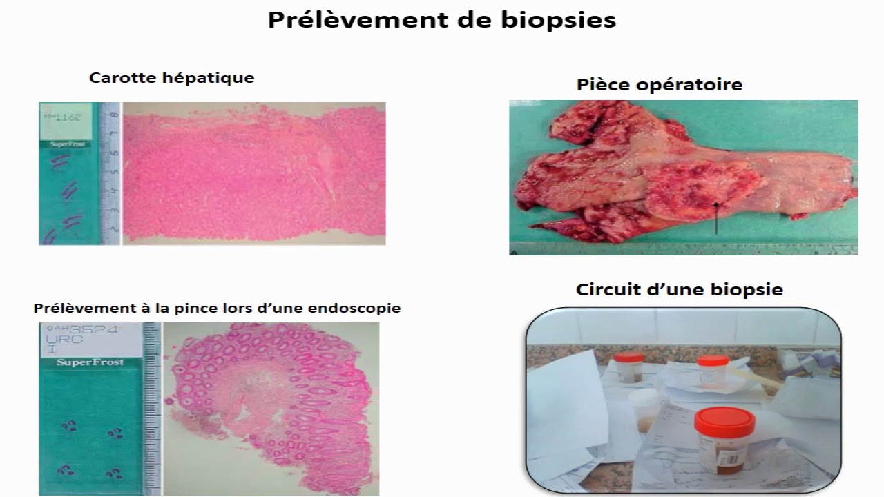 Instruments de mesure de la cellule