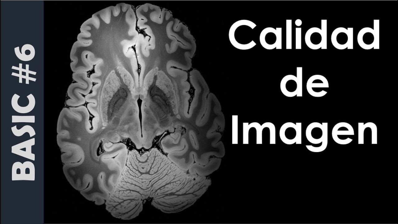 ✅Parámetros en Resonancia Magnética. CALIDAD de IMAGEN. La SEÑAL y RESOLUCIÓN. Curso Básico 6.