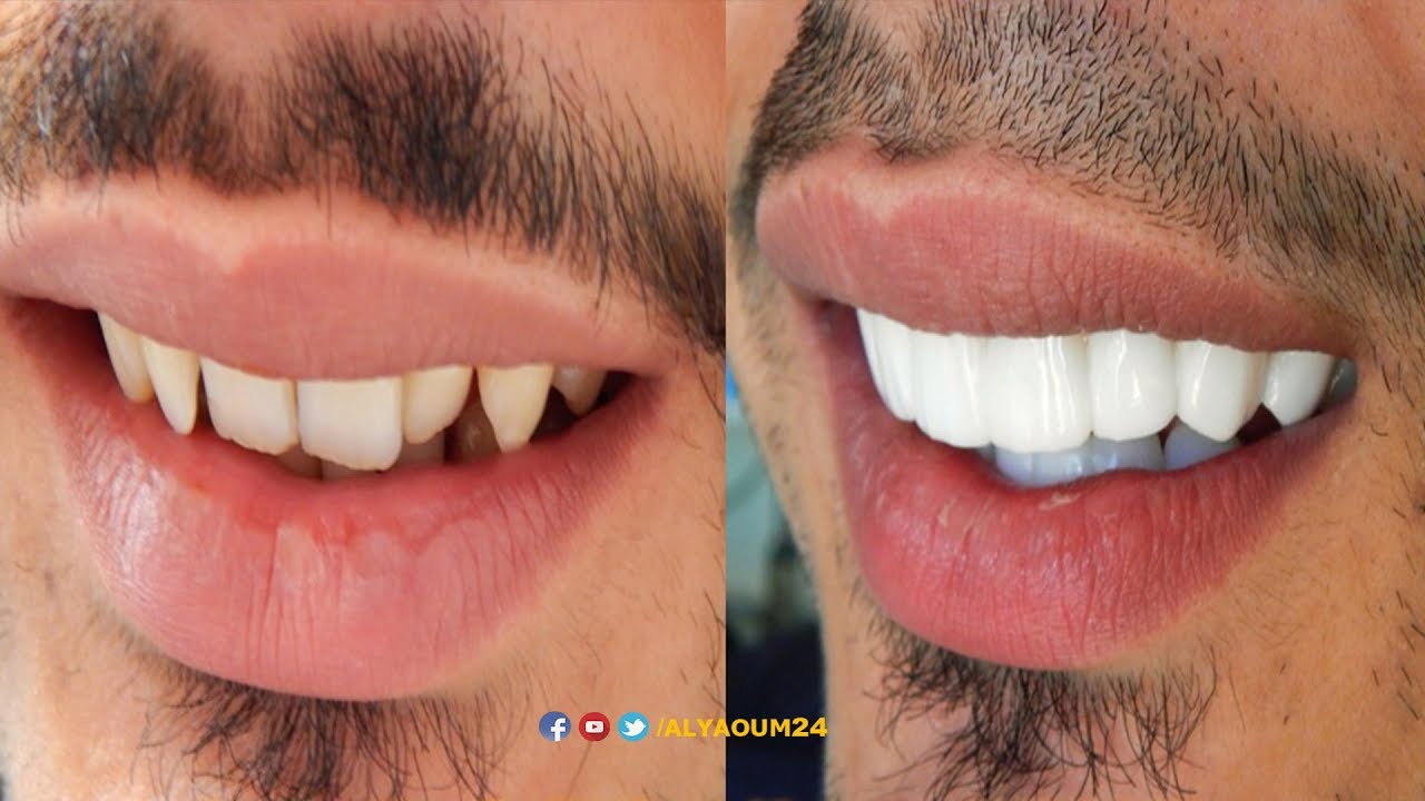 المغاربة و
