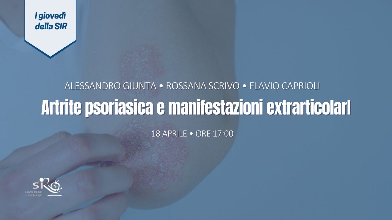 Giovedì della SIR | Artrite psoriasica e manifestazioni extrarticolari