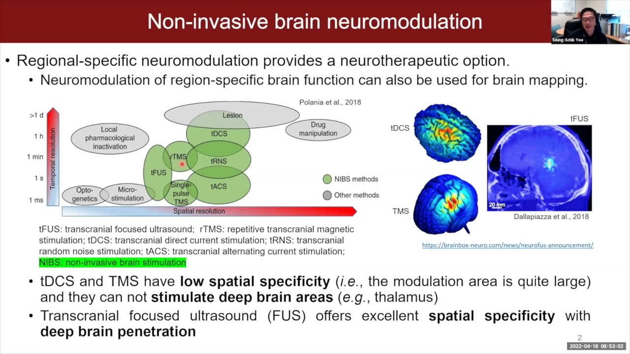 TSC2022 - Workshop 3 -  Ultrasonic Neuromodulation - Ultrasound Brain Simulation