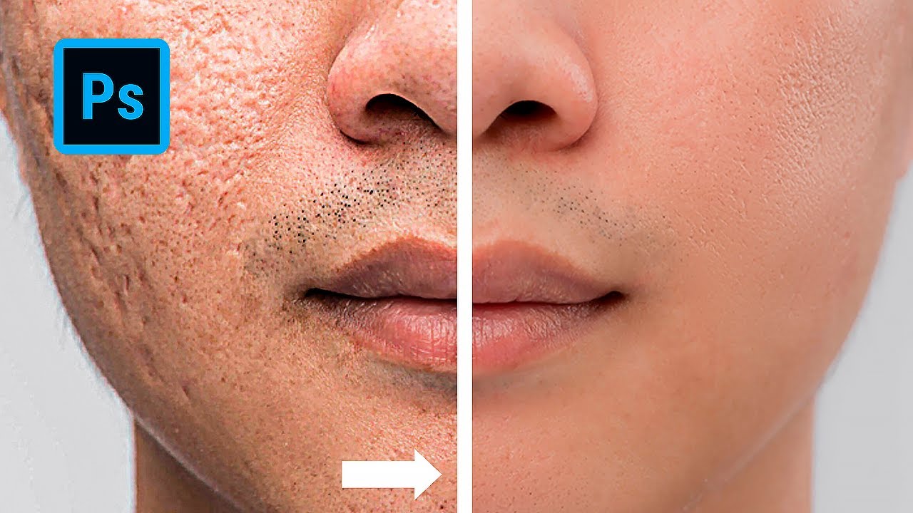 Retoque de piel profesional en Photoshop / Separación de Frecuencias