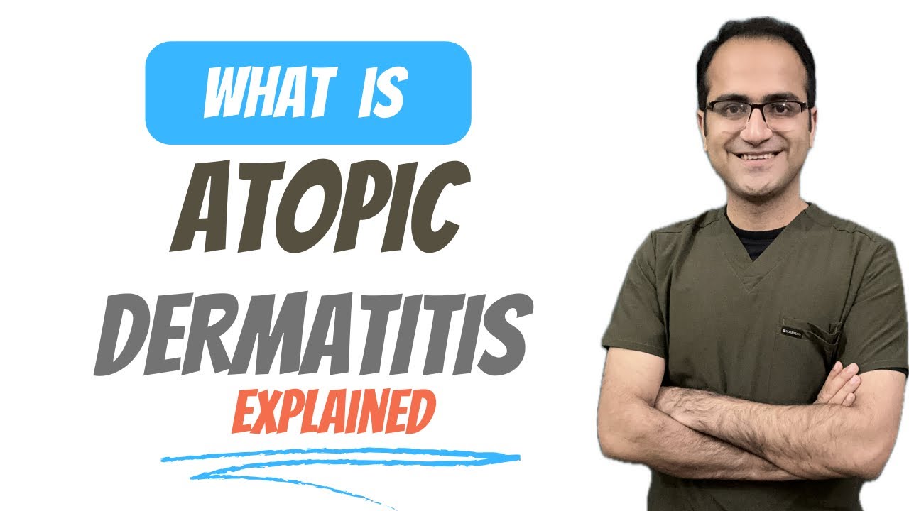 Atopic Dermatitis (Eczema) Medicine Lecture, Pathophysiology, Symptoms, Treatment USMLE NEETPG