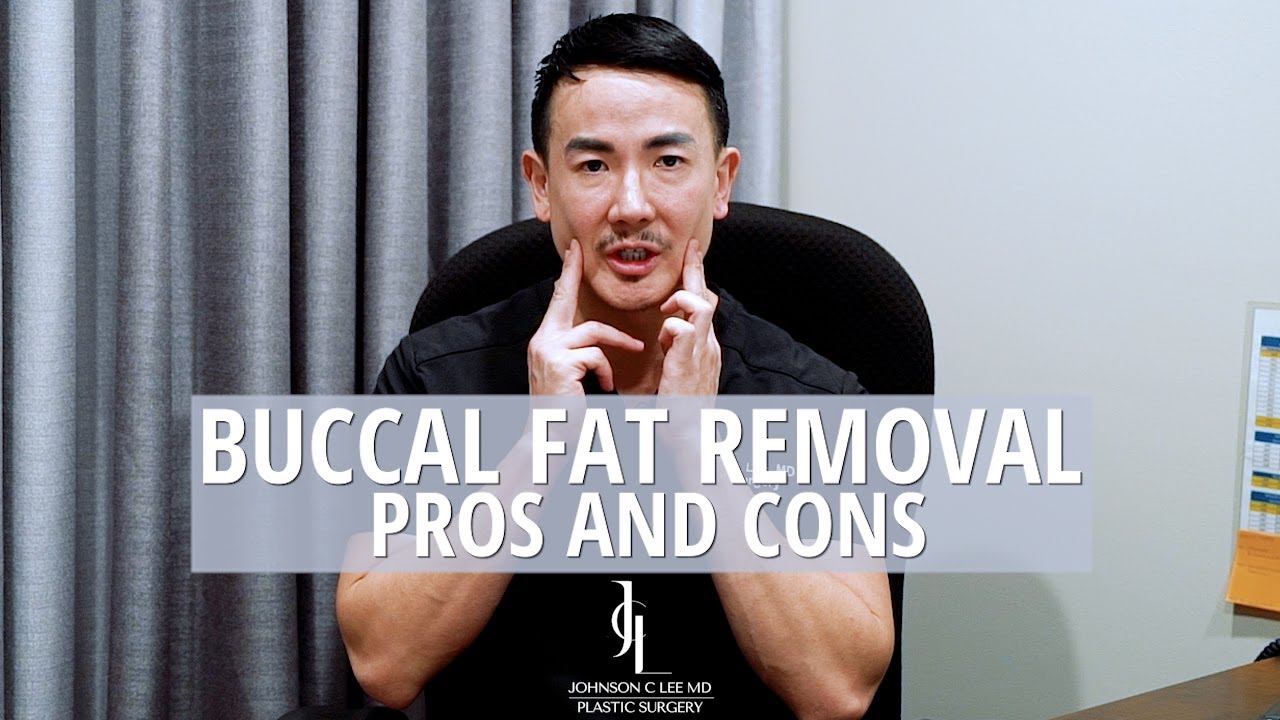 Buccal Fat Pad Removal Surgery: Exploring the Pros and Cons