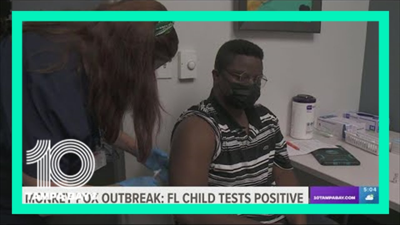 Florida reports 1st monkeypox case involving young child