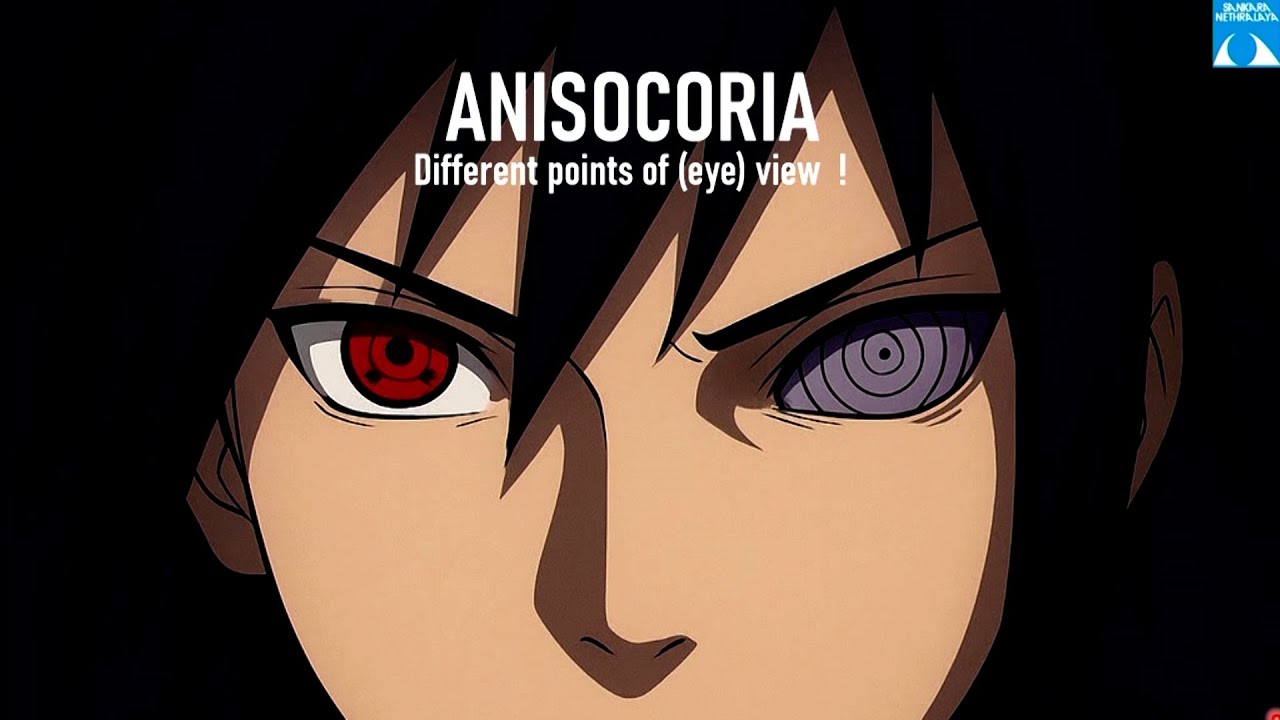 ANISOCORIA - Разные точки зрения!, д-р Яшада Шам Тарде, 25 ноября 2025 г.