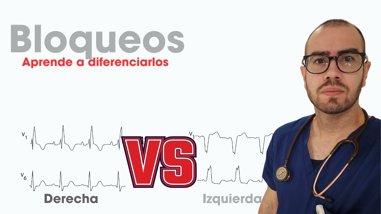 ¿Sabes diferenciar el bloqueo de rama derecha y rama izquierda? Aprende sus diferencias. 🤯