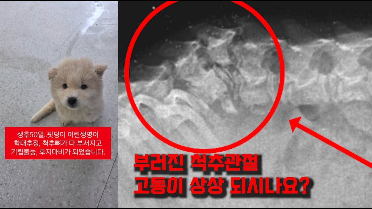 학대추정 척추골절 하지마비증상 흰밤이 / 모금3일차 / 도와주실 천사님들 커커커커먼 /3월16일 낮 라이브 소통 방송