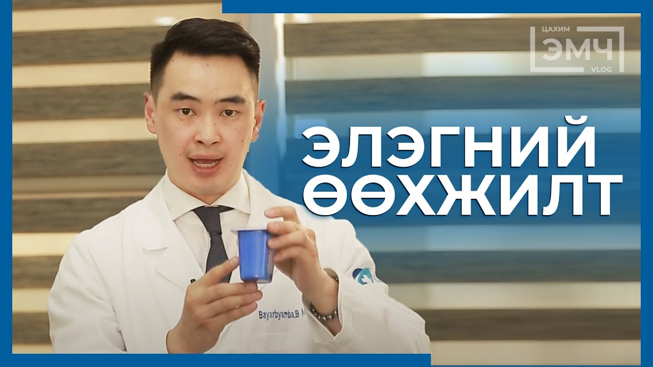 215 - Элэгний өөхжилт