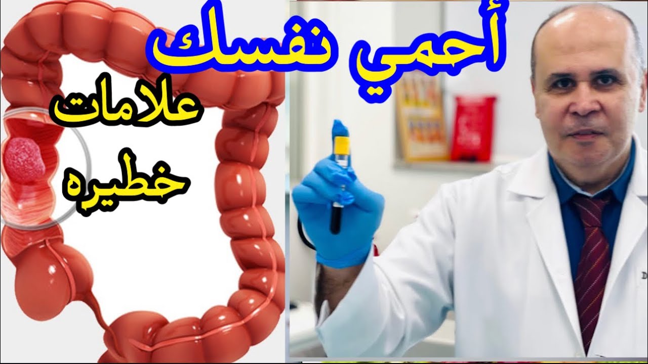 اكتشف الحقيقه 👈علامات لو ظهرت في جسمك تحذرك بوجود مرض خطير وكيف تعرف سرطان القولون