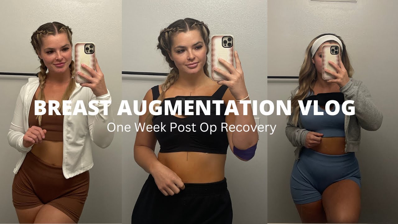 BREAST AUGMENTATION VLOG: my one week post op experience, regrets, how it went