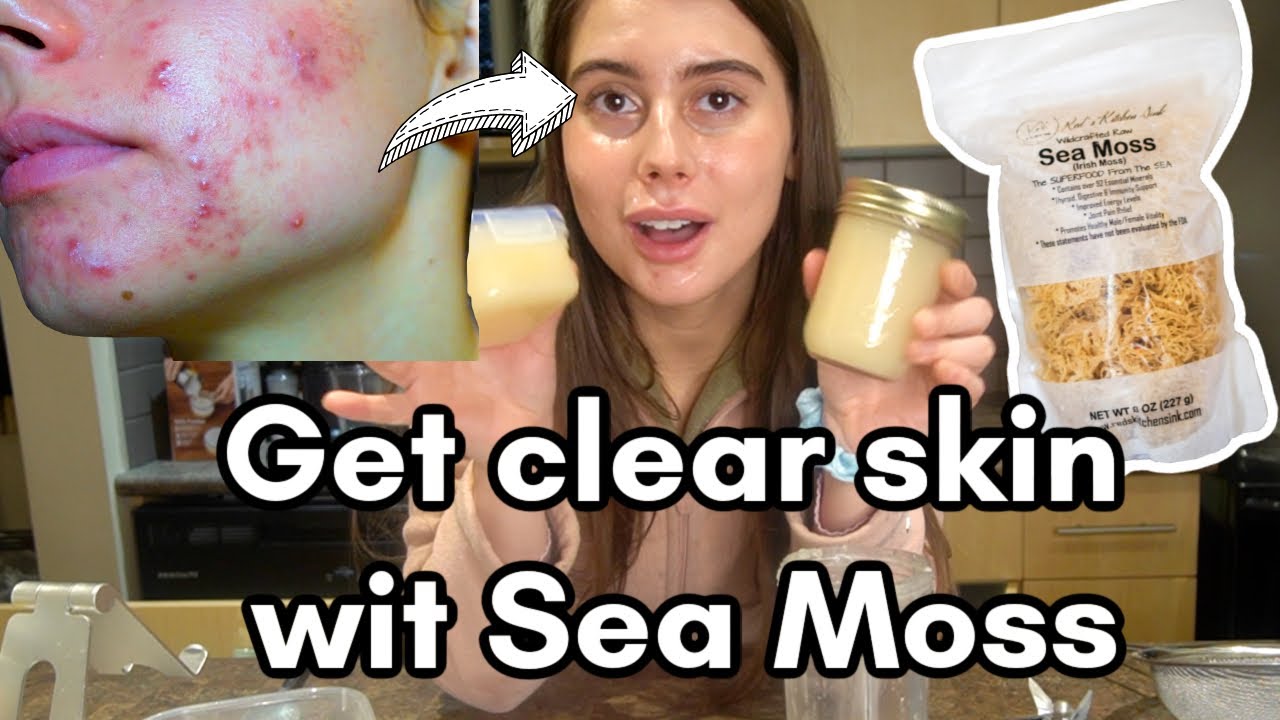 How to make Sea Moss for Acne Free Skin and Collagen Production!!!