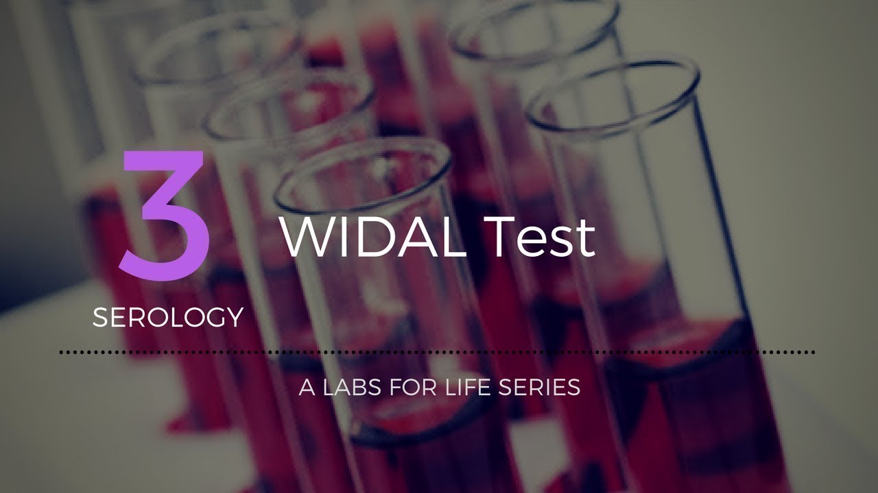 Widal test