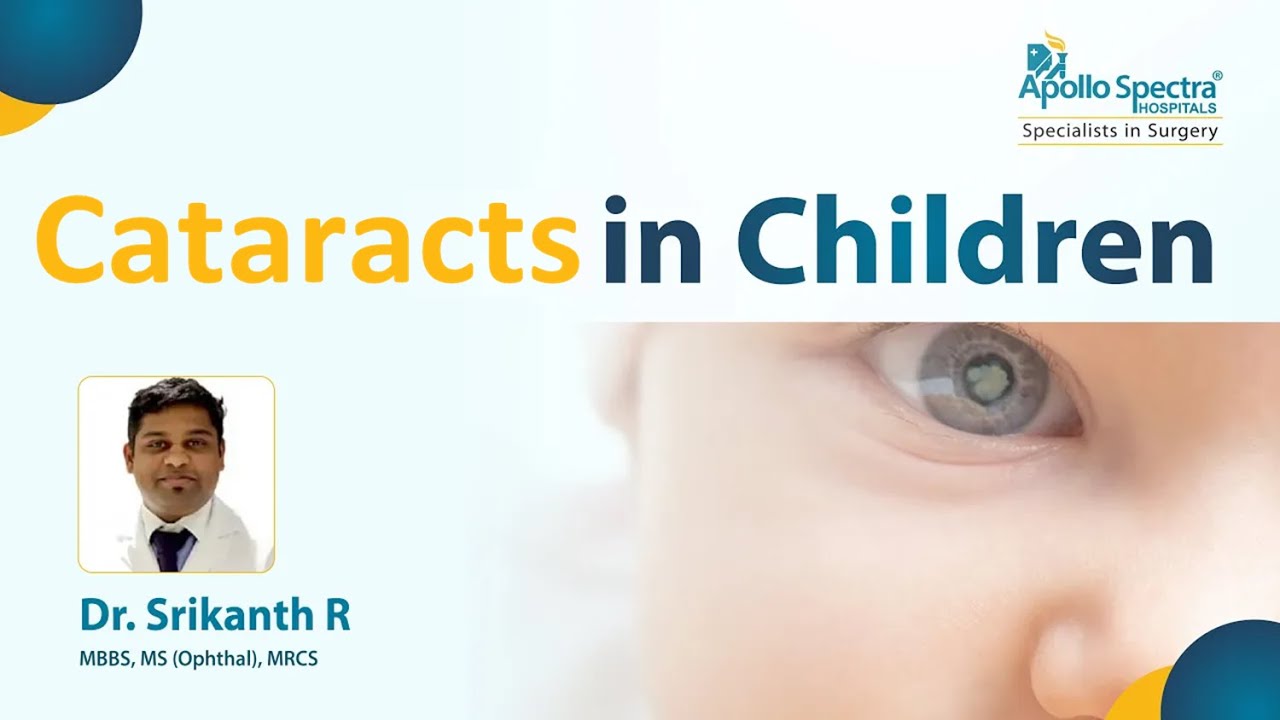 What are Paediatric cataracts?