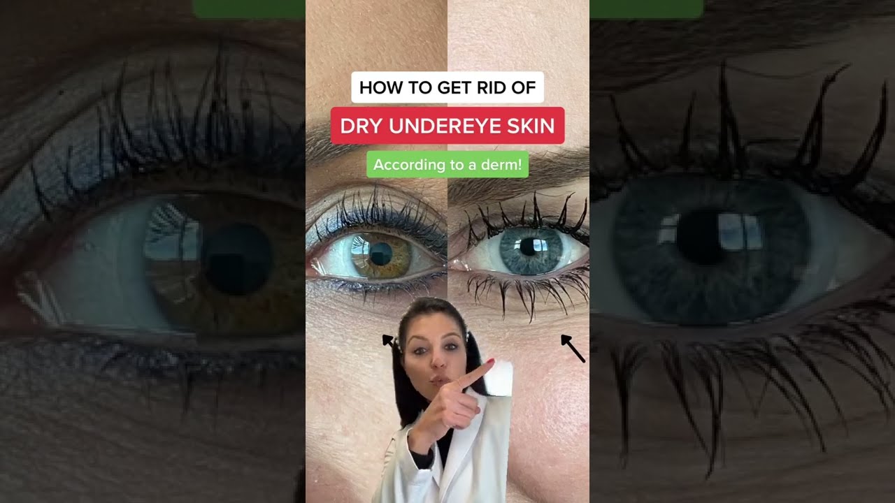 How to get rid of dry under eye wrinkles according to a dermatologist #shorts