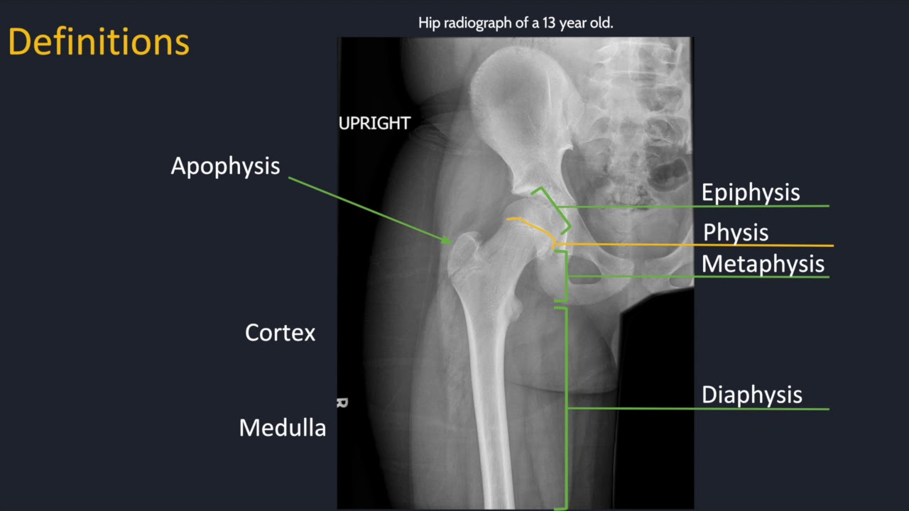 Approach to musculoskeletal radiology