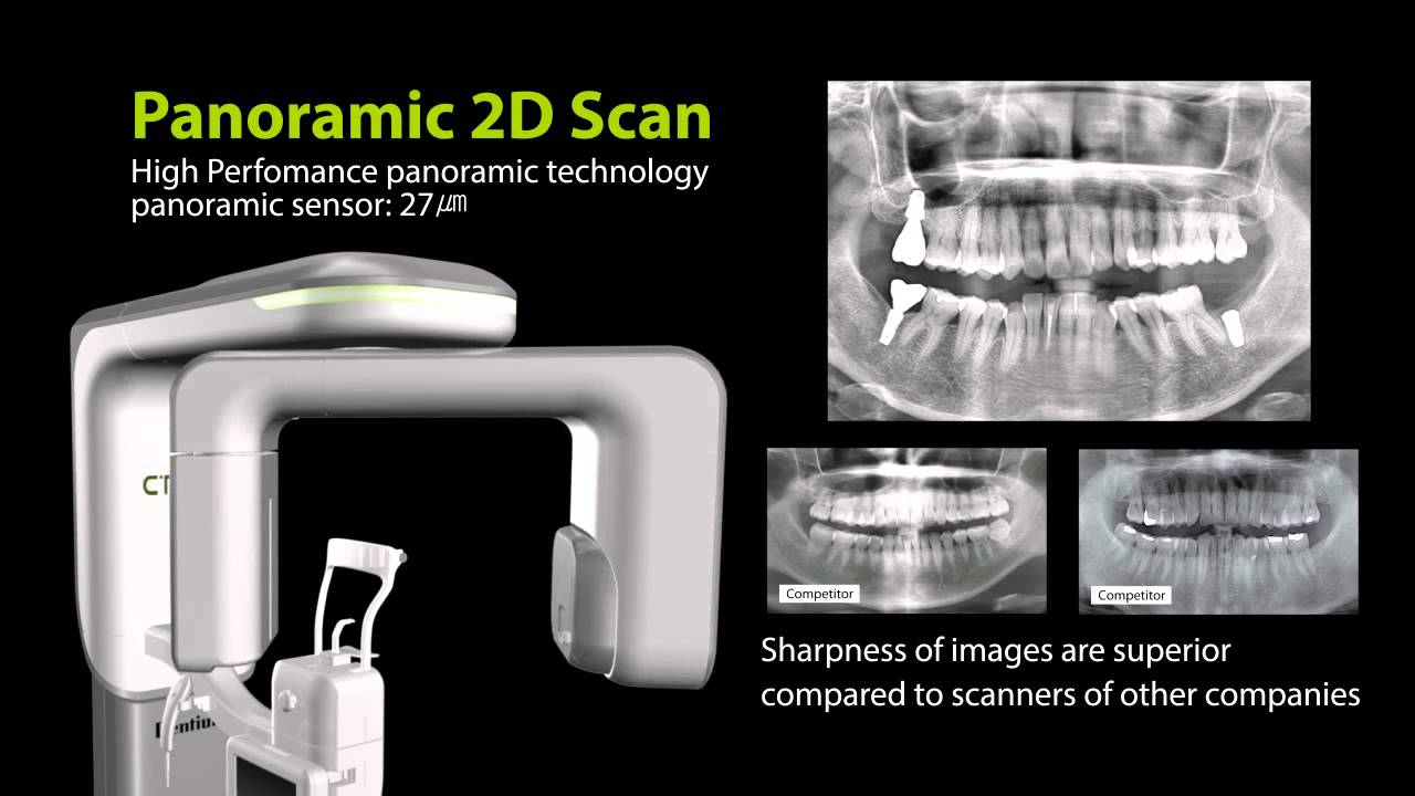CT SCAN