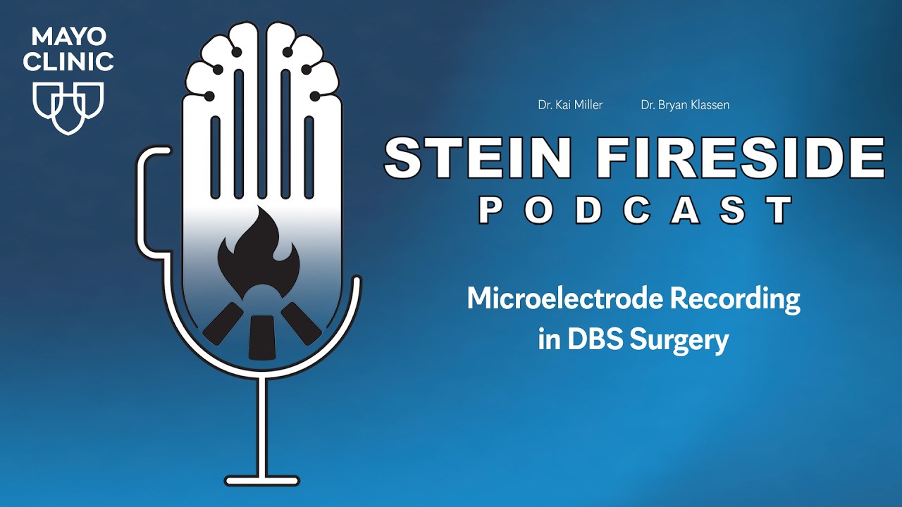 STEIN Fireside Podcast: Microelectrode Recording in DBS Surgery S1-Ep6