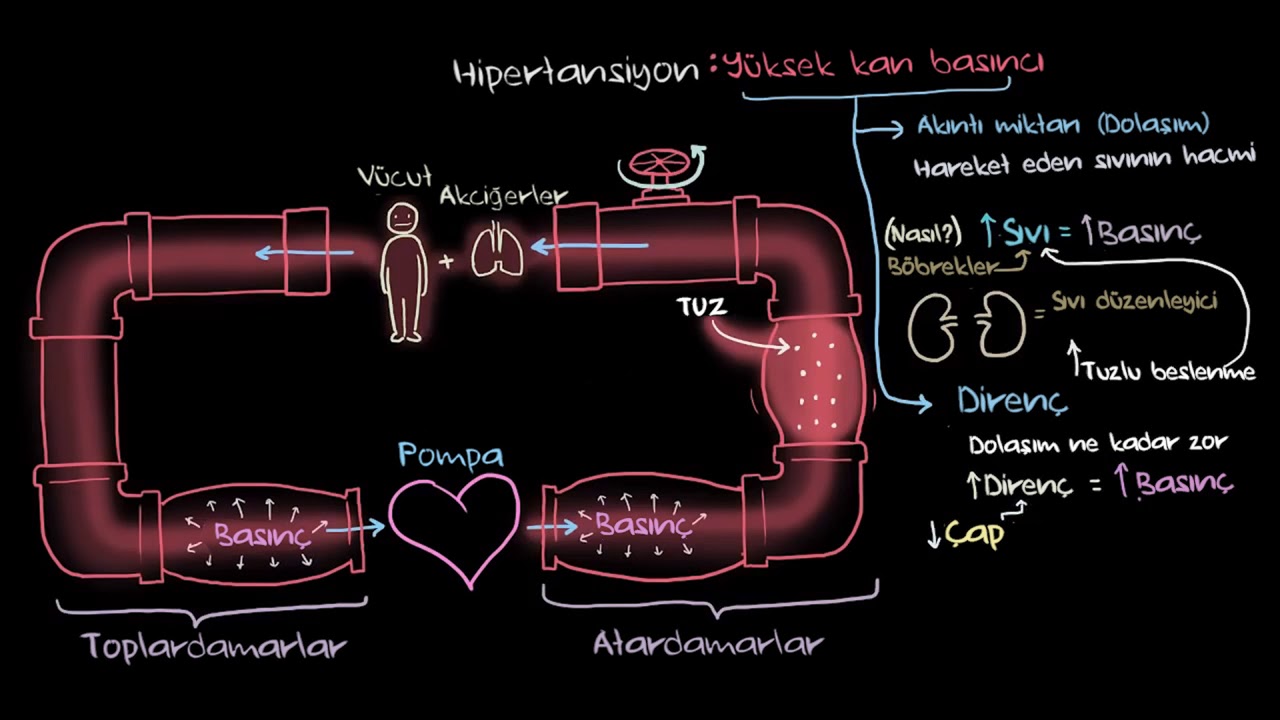 Hipertansiyon (Yüksek Tansiyon) Nedir? (Fen Bilimleri) (Sağlık ve Tıp)