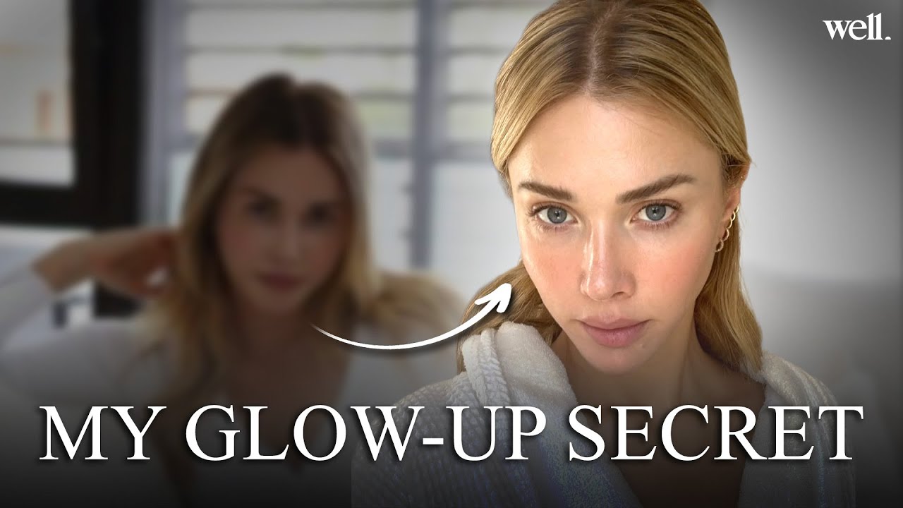 The One Procedure That Changed My Face (And Why I Stopped Botox)