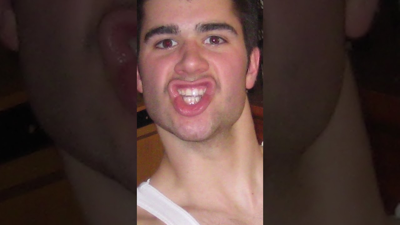 My Neck Was So Skinny... So I grew It Wide How? #Shorts