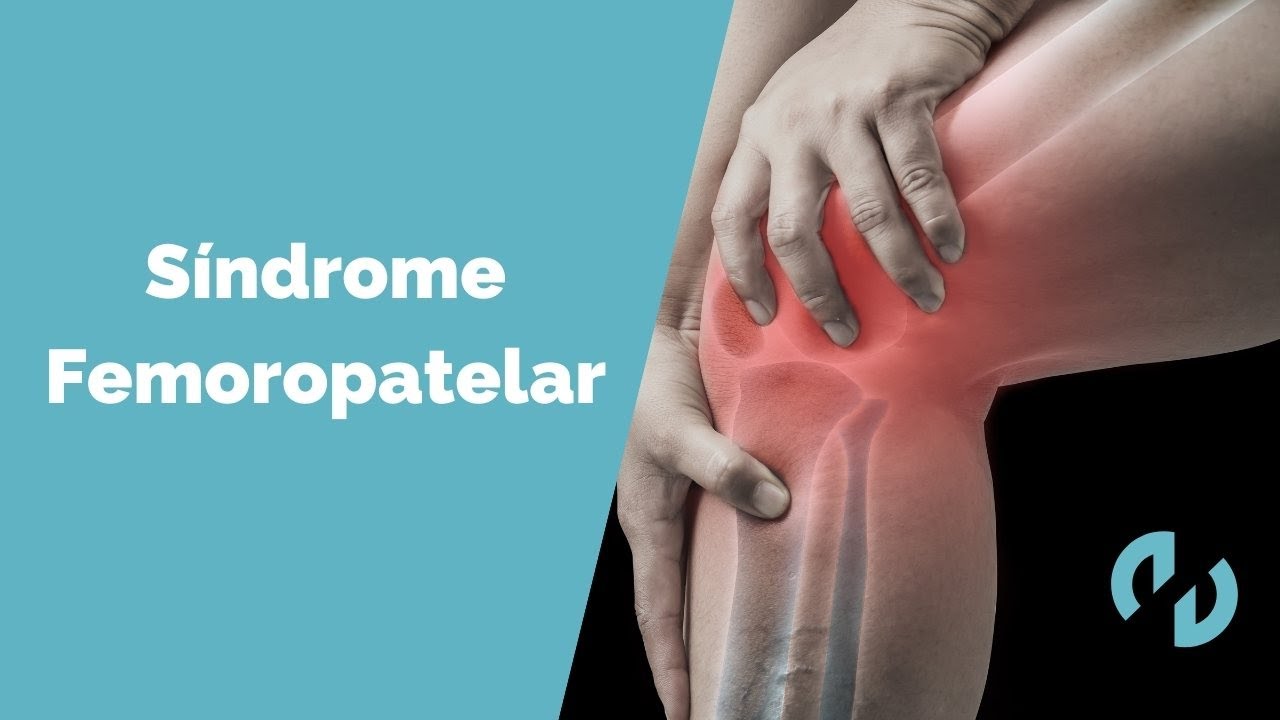 Síndrome Femoropatelar - AD Fisioterapia Valencia