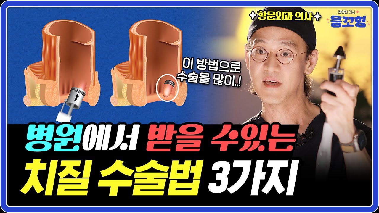 치질 수술! 이 영상 보기전엔 하지 마세요! l 항문외과 의사가 알려주는 나에게 맞는 치질 수술법!