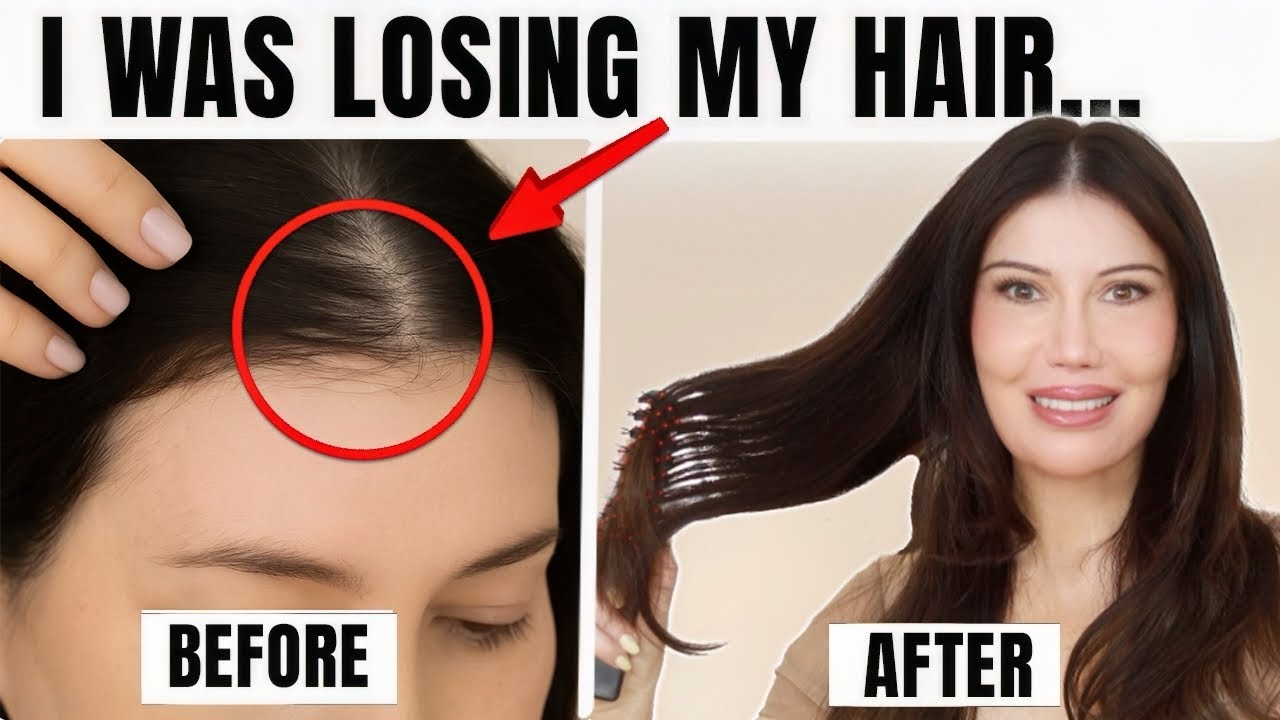I Was Losing My Hair&hellip; Until I Did This