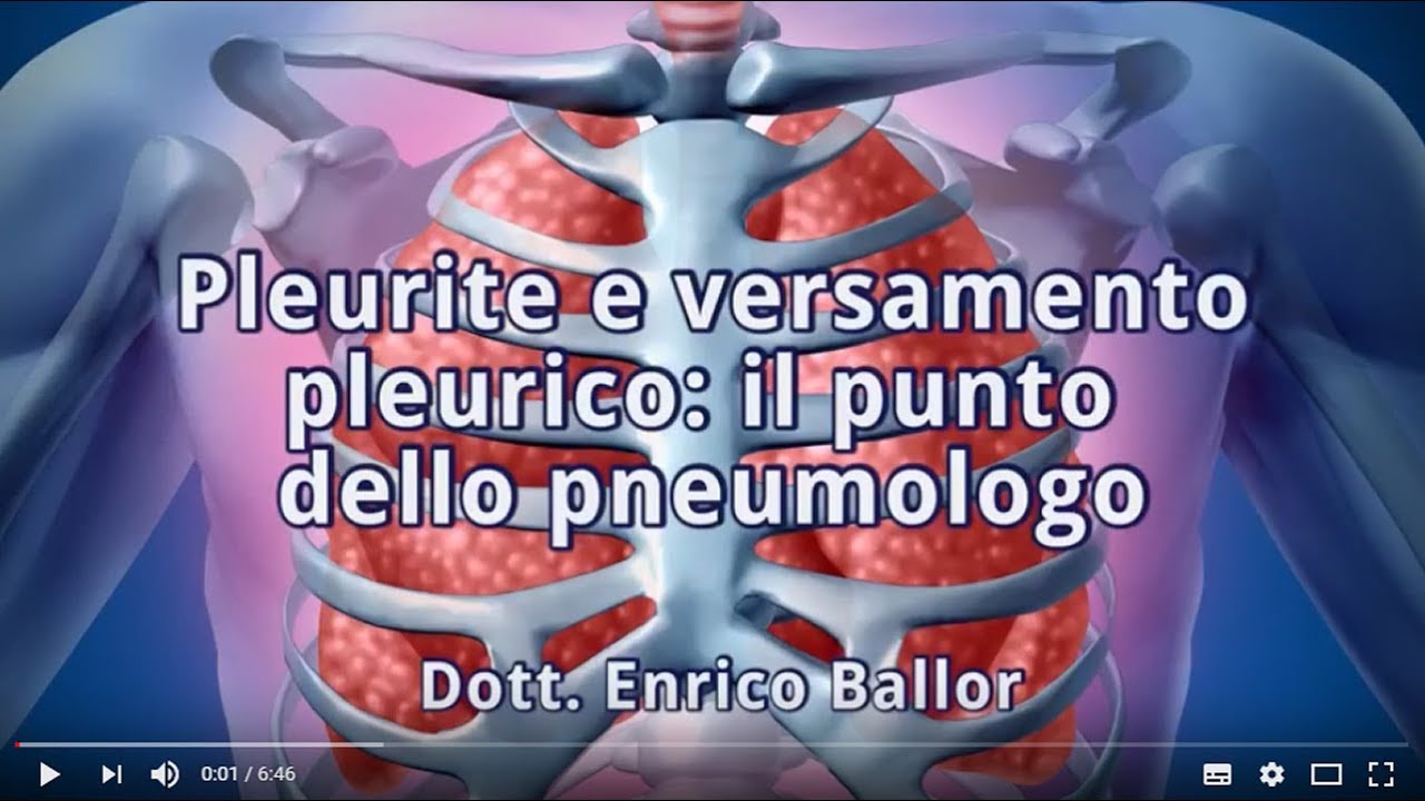 Pleurite e versamento pleurico: il punto dello pneumologo