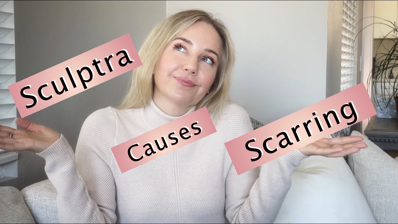 Should You Avoid Sculptra? Especially if You Want a Facelift!